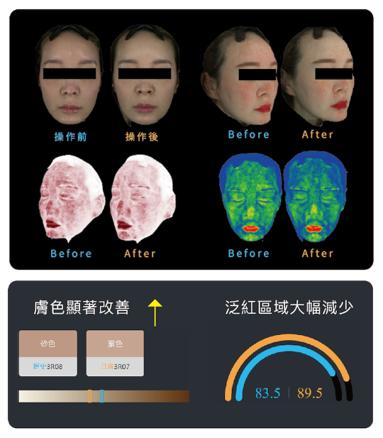 酷雪實證對比圖一